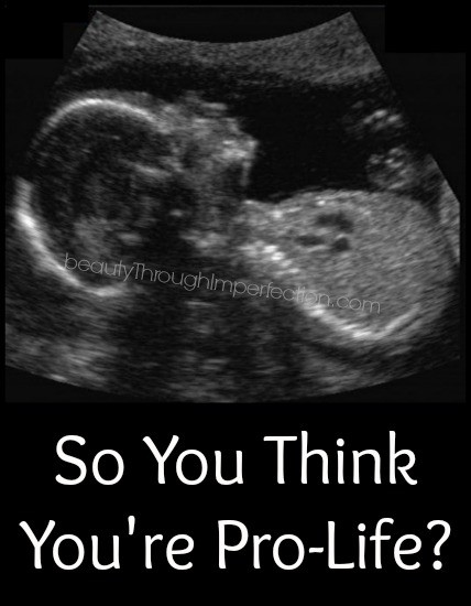 so you think you're pro-life