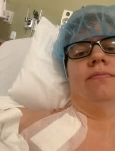 port placement surgery